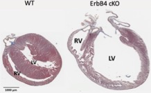 Development of heart failure in mice lacking cardiomyocyte ErbB4 receptors (cKO) 