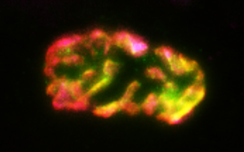  synaptic vesicles within the motor nerve terminal (pink) that overlay acetylcholine receptors (red) and muscle specific Kinase (green). Image by Ali Damen – Noakes Lab. 6)