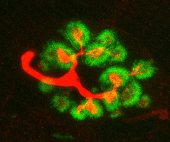 Human neuromuscular synapse (motor nerve to muscle connection; Red motor axons and their terminal endings; Green muscle acetylcholine receptors) – image by P.G. Noakes – Noakes Lab