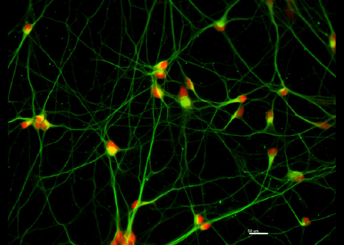 Human Motor neurons derived from Stem cells – (Green Acetylcholine Transferase Red Islet 1) Image by Dr Qiao Ding – Noakes Lab