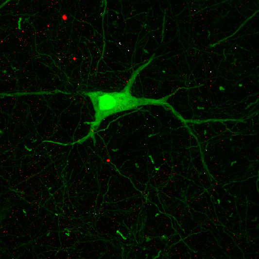 Alpha Motor Neuron (green) surrounded TrkB puncta (red) – image by Ben Adams - Noakes Lab.