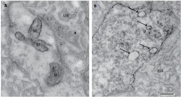 Dscam2 is trafficked to different intracellular compartments