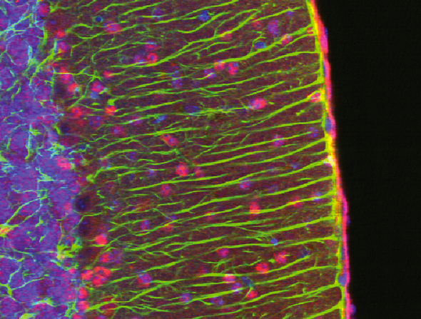 The cerebellum