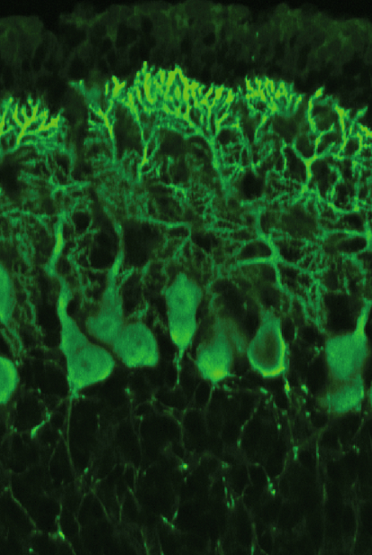 Purkinje neurons – masters of integration