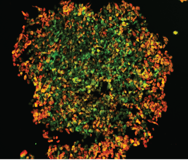 Cultured melanoma cells