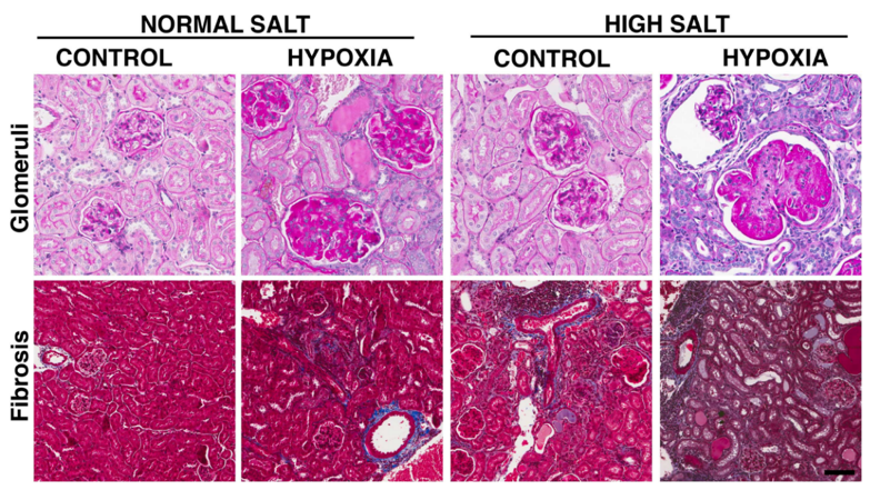 Histological sections of kidneys from mouse offspring exposed to prenatal hypoxia and a high salt diet and appropriate controls