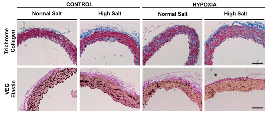 Microphotographs of aortic sections in mouse offspring exposed to prenatal hypoxia and a high salt diet and appropriate controls