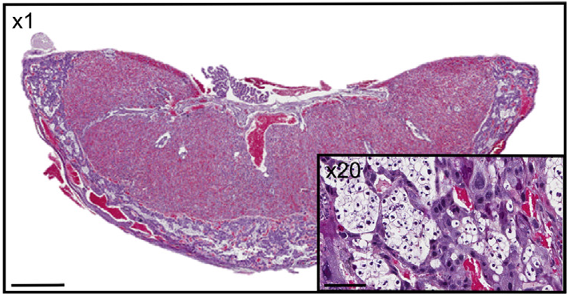 Periconceptional alcohol exposure causes morphological changes in the placenta in a rat model, with increased glycogen stores evident in female placentas