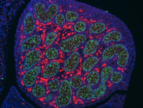 1.Sex specific development of fetal germ cells