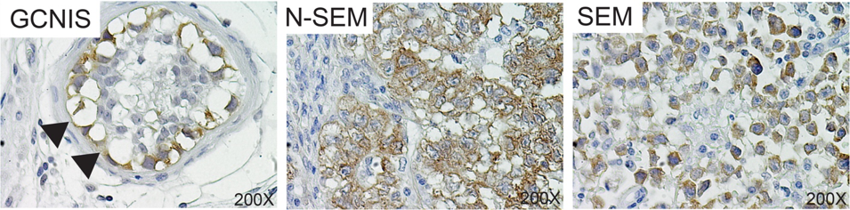 The genesis of germline tumorigenes