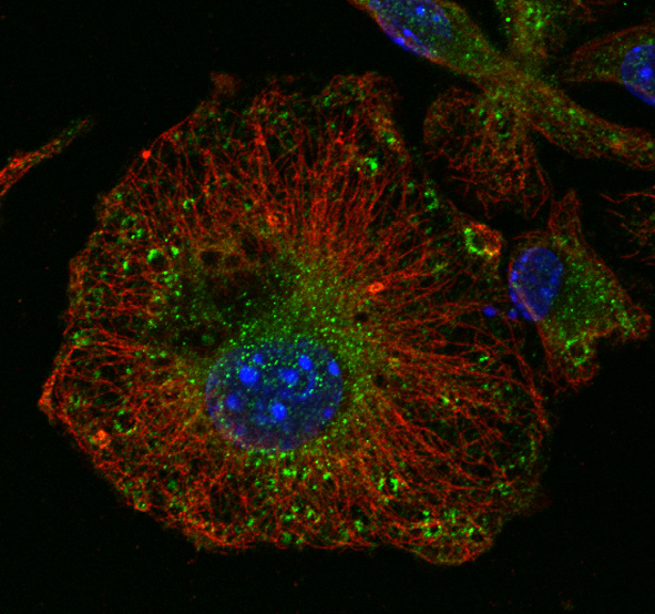 Retromer-dependent protein trafficking and adipocyte biology