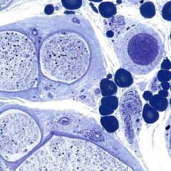 ARC Discovery Grant success