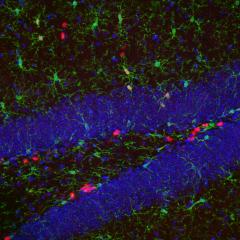 Unlocking the immune system to help repair the brain