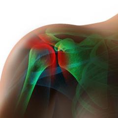The role of shear wave elastography in quantifying musculotendinous mechanical properties: Investigations in healthy and diseased tendon and the response to eccentric exercise