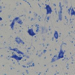 Motor neurons in the spinal cord