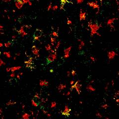 Cooling 'brains on fire' to treat Parkinson's