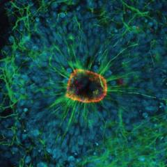 Red: Tight junction marker (Zo-1)  demonstrating the apical surface. Green:  Cytoskeleton marker (TUBB-3) showing  the radial structure of the rosettes. Blue:  Nucleus of cells (DAPI)