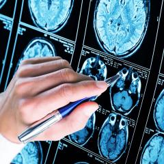 Brain scan