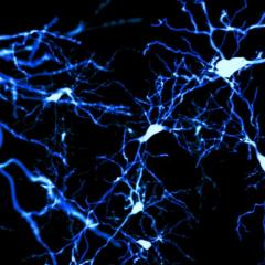 Pyramidal neurons